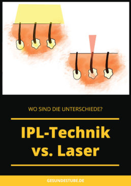 IPL vs Laser. Wo sind die Unterschiede?